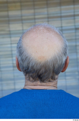 Head Hair Man White Casual Average Bald Street photo references